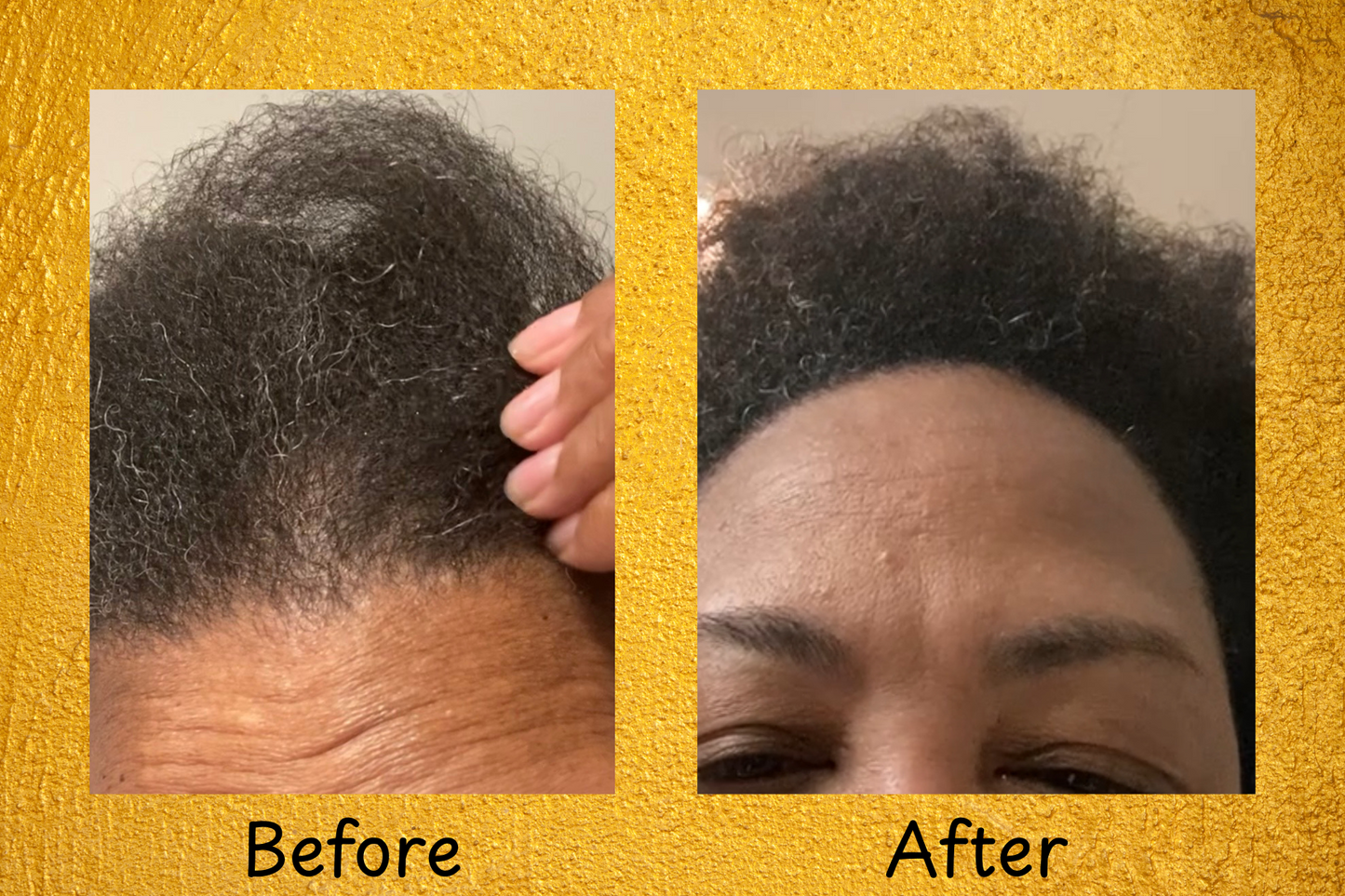Organic Herbal Hair Oil – Regrow, Strengthen & Nourish | Khirazani Essentials