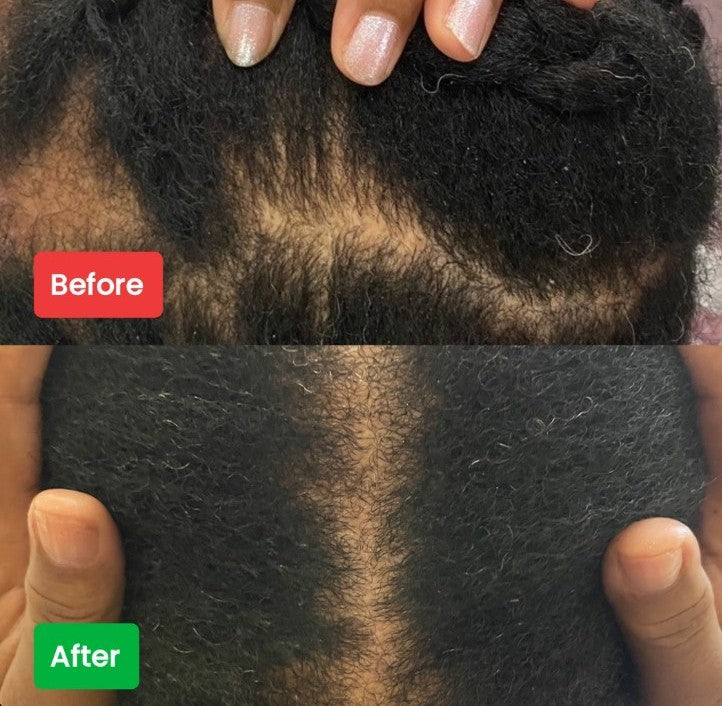 Organic Herbal Hair Oil – Regrow, Strengthen & Nourish | Khirazani Essentials